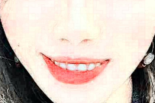 2024天津醫(yī)科大學第二醫(yī)院口腔科種植牙做的好嗎_體驗分享