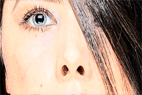 中山大學附屬第一醫(yī)院光子嫩膚掛什么號?2024光子嫩膚價格