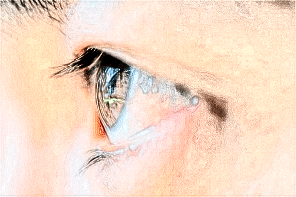 中山大學(xué)附屬第一醫(yī)院激光近視怎么樣?2024激光近視價(jià)格