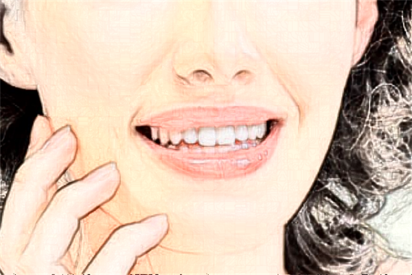 佛山市禪城區(qū)中心醫(yī)院皮膚科熱瑪吉好不好?熱瑪吉的作用