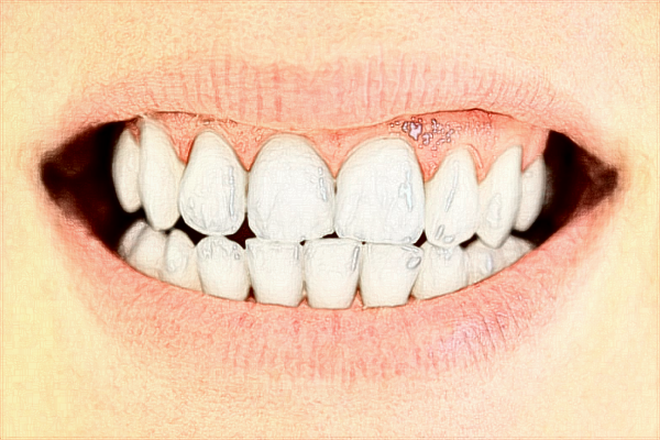 中山大學(xué)附屬口腔醫(yī)院正畸醫(yī)生好嗎?2024收費價格