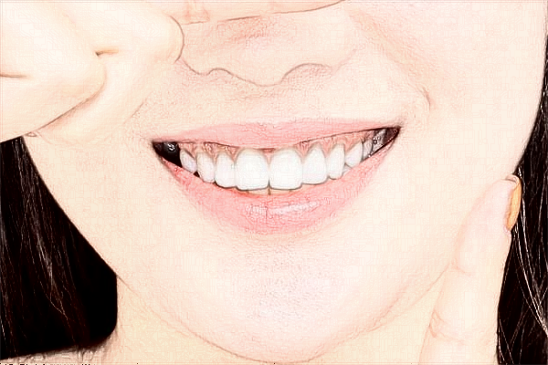 中山大學(xué)附屬口腔醫(yī)院正畸醫(yī)生好嗎?2024收費價格