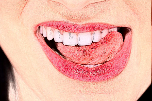 2024安徽省立醫(yī)院根管做牙套多少錢