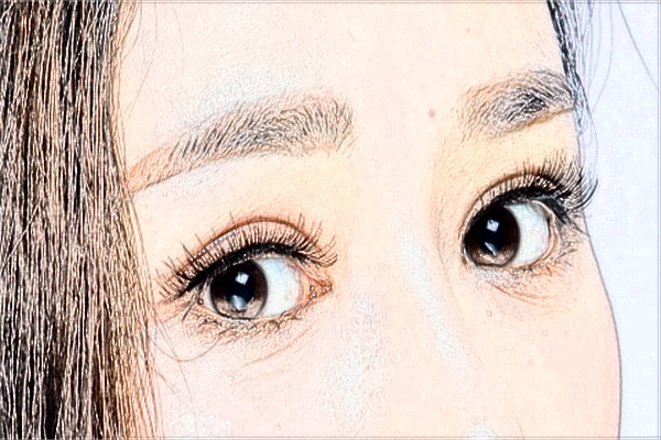 河北省人民醫(yī)院割雙眼皮做的怎么樣_哪位醫(yī)生技術比較好