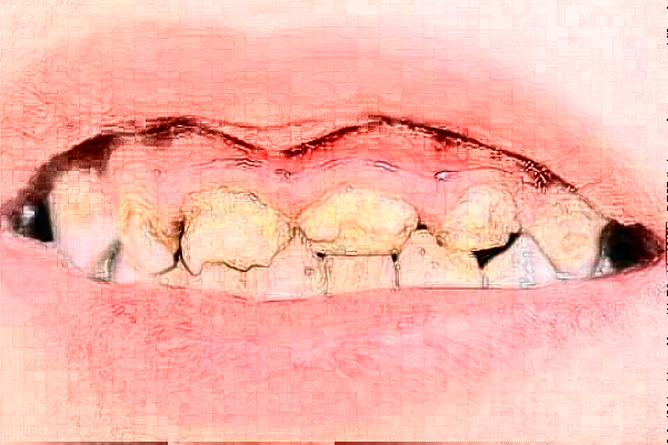 大連新華醫(yī)院口腔科埋伏齒拔除價(jià)格表_醫(yī)生推薦