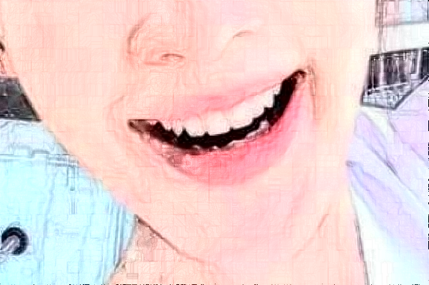 蘇州大學附屬兒童醫(yī)院口腔科微創(chuàng)拔牙價格表(價目表)怎么樣