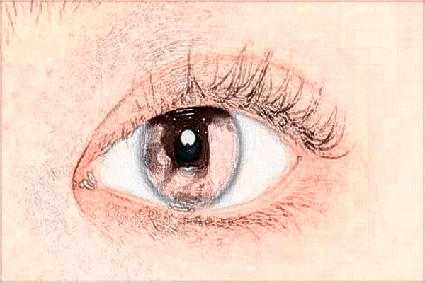 2024南寧303醫(yī)院近視激光手術(shù)多少錢?近視激光手術(shù)要求度數(shù)