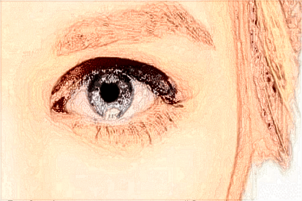 2024南寧303醫(yī)院近視矯正價(jià)格?近視矯正手術(shù)副作用