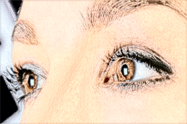 貴陽醫(yī)學(xué)院附屬醫(yī)院做近視矯正手術(shù)價格?做近視矯正手術(shù)好嗎