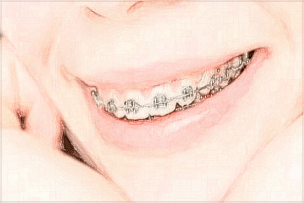 青島海慈醫(yī)院口腔科主任好不好?2024收費價格