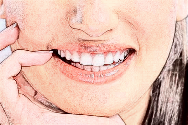 青島海慈醫(yī)院口腔科怎么樣?口腔科怎么檢查