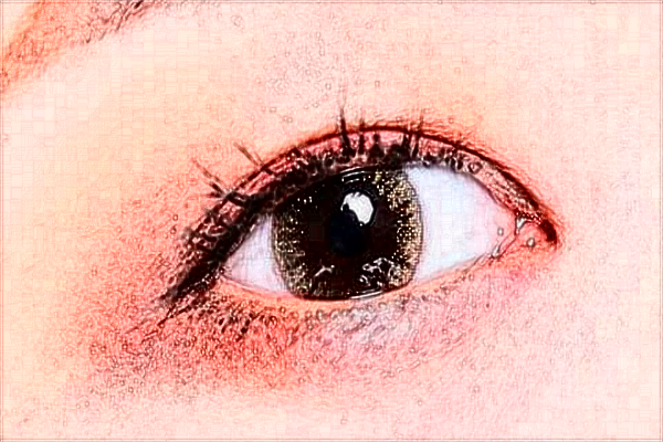 2024河北省人民醫(yī)院全飛秒做的怎么樣_哪位醫(yī)生技術比較好