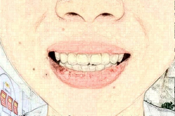 2024杭州市第一人民醫(yī)院口腔科種植牙修復(fù)價(jià)格表_醫(yī)生排名