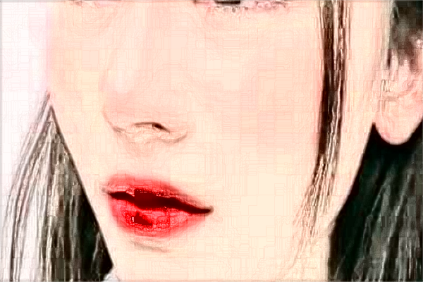 2024河北省人民醫(yī)院激光祛斑做的好嗎?整形日記分享