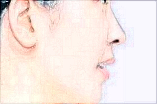 南京鼓樓醫(yī)院做的好嗎？誰做的好