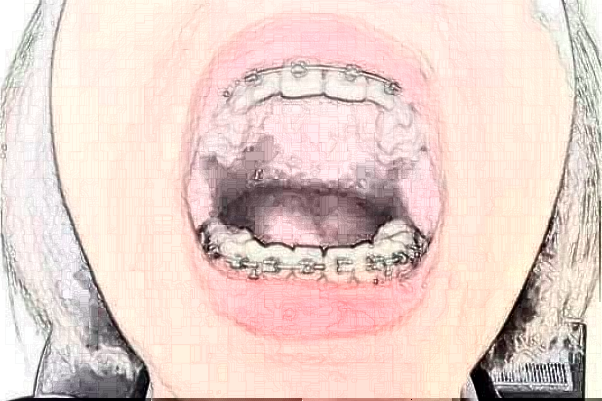 吉林大學第一醫(yī)院口腔科怎么樣_專家介紹