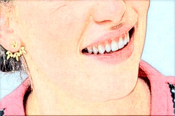 2024天津醫(yī)科大學總醫(yī)院口腔科頜面畸形矯正做的好嗎?哪位醫(yī)生比較有名氣