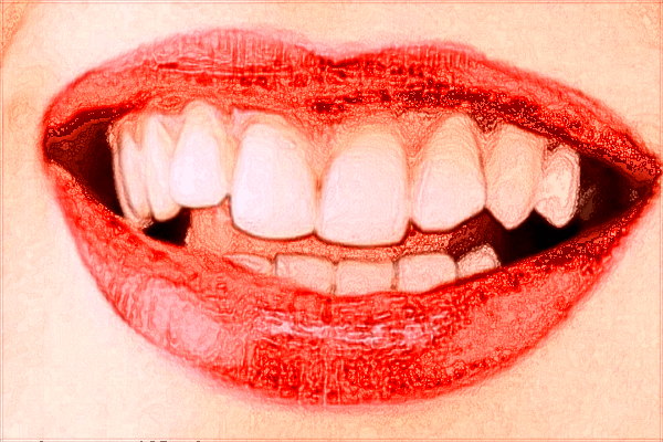 中山大學(xué)附屬第二醫(yī)院牙科怎么樣?2024牙科收費如何