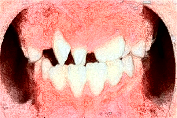 貴陽市第二人民醫(yī)院口腔科張紅好不好?張紅醫(yī)生什么?