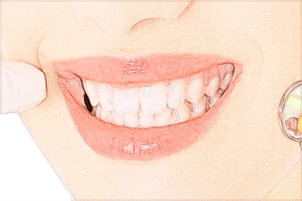 山東省千佛山醫(yī)院口腔科王國相怎么樣?口碑好不好?