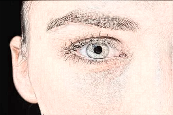 蘭州大學(xué)第二醫(yī)院全飛秒怎么樣?全飛秒和半飛秒哪個更好