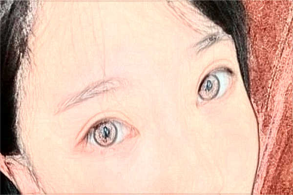 2024山西醫(yī)科大學(xué)第一醫(yī)院半飛秒怎么樣_整形日記分享