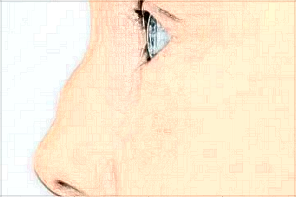 哈爾濱醫(yī)科大學(xué)附屬第一醫(yī)院隆鼻做的好嗎_隆鼻整形日記分享