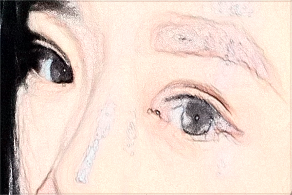 2024南京鼓樓醫(yī)院近視眼手術(shù)多少錢?醫(yī)生名單推薦