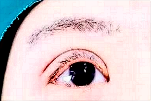 南京鼓樓醫(yī)院全飛秒激光手術(shù)多少錢?醫(yī)生名單推薦