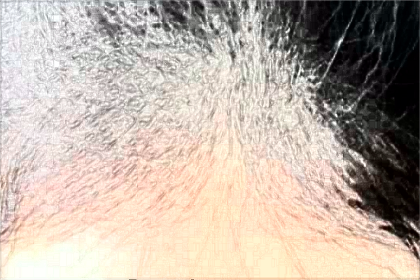 南通大學(xué)附屬醫(yī)院植發(fā)做的好嗎？誰(shuí)做的好