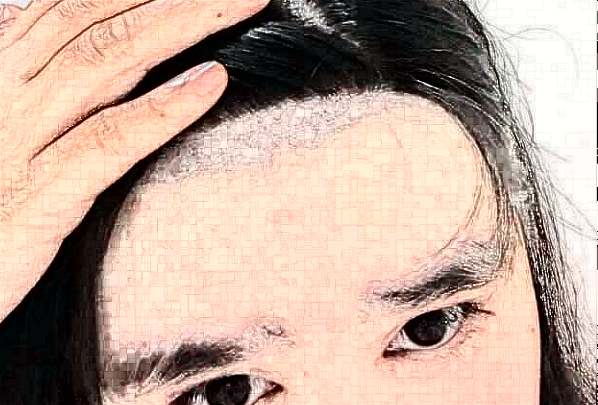 太原市中心醫(yī)院植發(fā)怎么樣_哪個醫(yī)生比較好