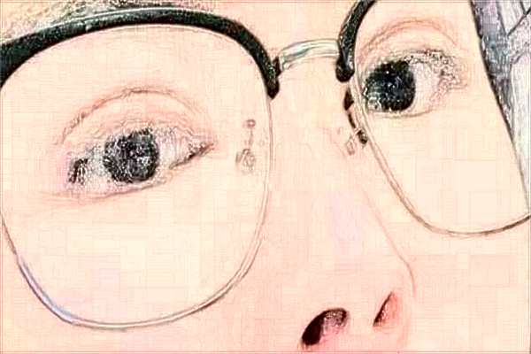 2024天津市醫(yī)科大學眼科醫(yī)院半飛秒價格多少?做的怎么樣