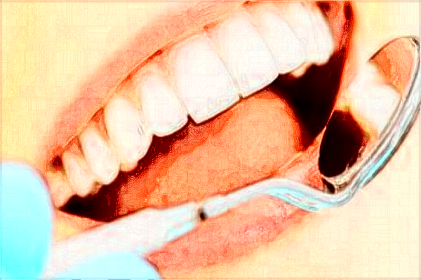 2024中山大學(xué)附屬第三醫(yī)院隱形牙套多少錢?隱形牙套貴嗎