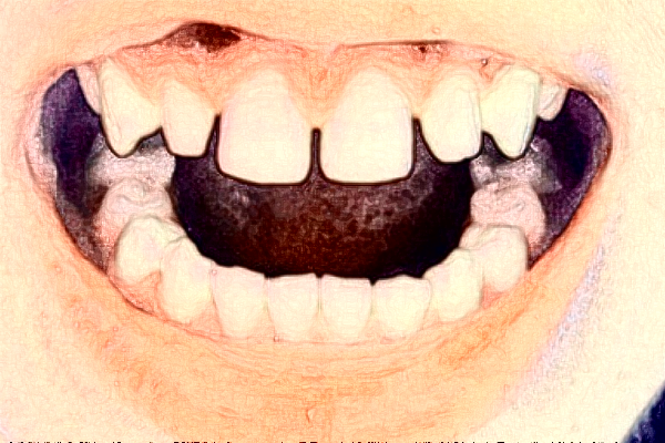 南通大學(xué)附屬醫(yī)院隱形正畸做的好嗎？誰做的好