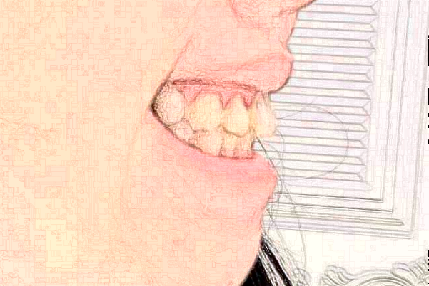 江蘇大學(xué)附屬醫(yī)院口腔科錯(cuò)牙合畸形矯正怎么樣_專家名單