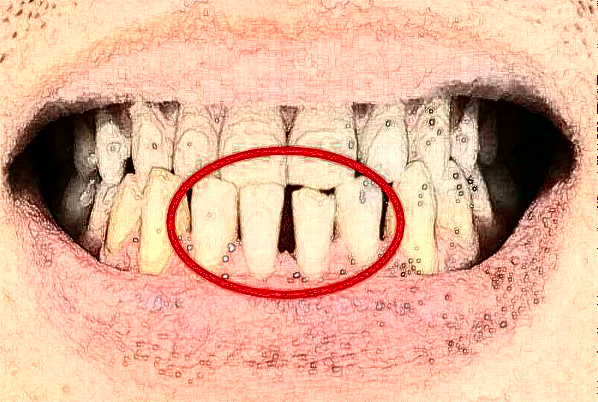 天津醫(yī)科大學(xué)第二醫(yī)院口腔科正畸怎么樣_哪個醫(yī)生比較好