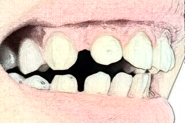 2024揚(yáng)州市第一人民醫(yī)院整牙醫(yī)生排名_口碑+價格