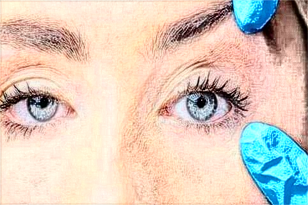 吉林大學(xué)第一醫(yī)院半飛秒做的好嗎?誰(shuí)做得好