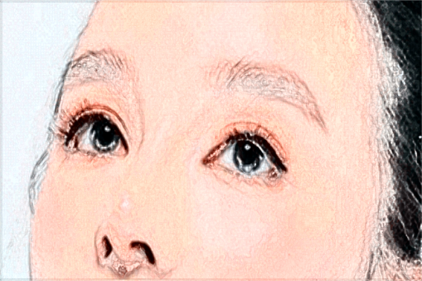 中山大學(xué)附屬口腔醫(yī)院矯正視力好嗎?矯正視力手術(shù)多少錢