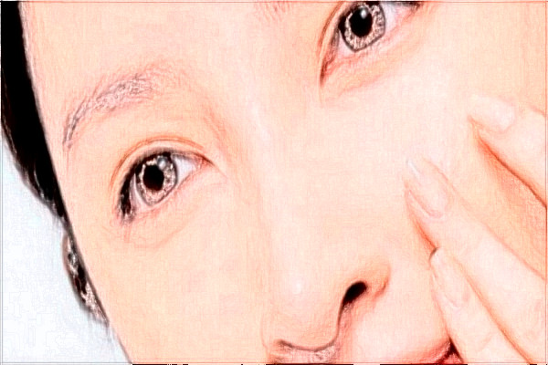 2024天津醫(yī)科大學(xué)總醫(yī)院可以去胎記嗎？去胎記真實案例