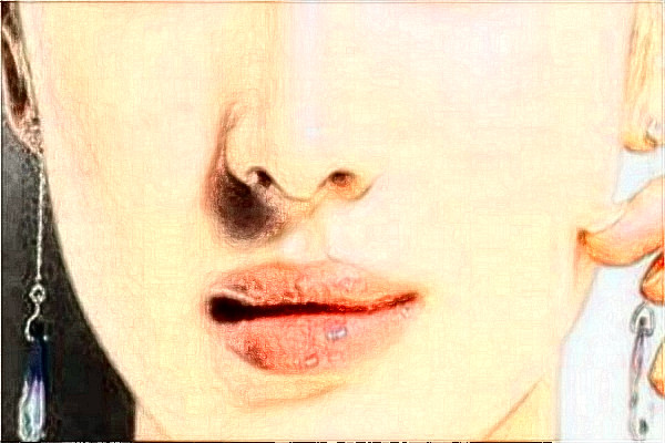 2024天津醫(yī)科大學(xué)總醫(yī)院可以去胎記嗎？去胎記真實案例