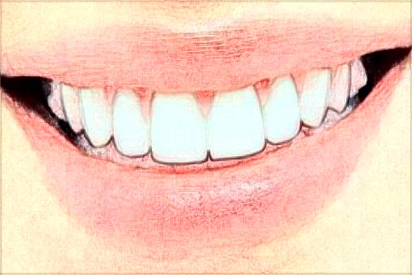 2024江蘇大學(xué)附屬醫(yī)院口腔科全口牙種植價目表(價格表)怎么樣