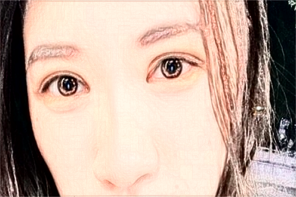 揚(yáng)州市第一人民醫(yī)院全飛秒價(jià)格多少?做的怎么樣