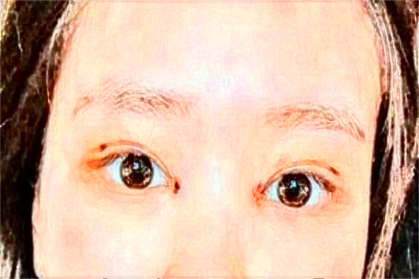 揚(yáng)州市第一人民醫(yī)院全飛秒價(jià)格多少?做的怎么樣