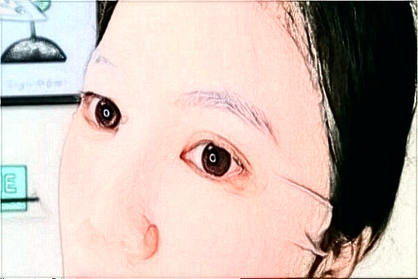 阜陽市人民醫(yī)院全飛秒價目表(價格表)怎么樣