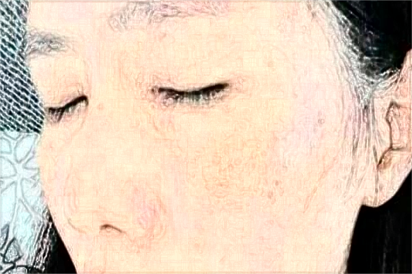 珠海市人民醫(yī)院祛斑怎么樣?2024祛斑激光費用多少