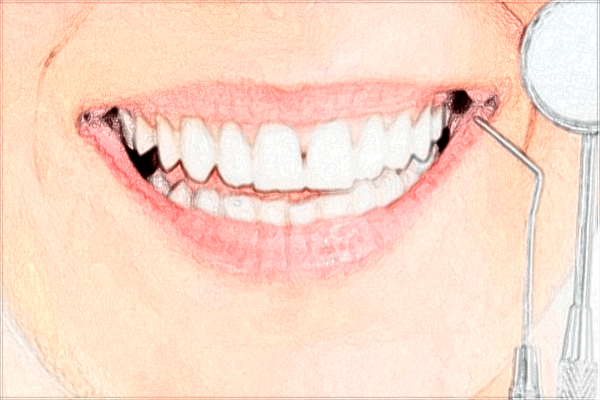 2024?？谑腥嗣襻t(yī)院牙科價目表?牙科醫(yī)生好嗎