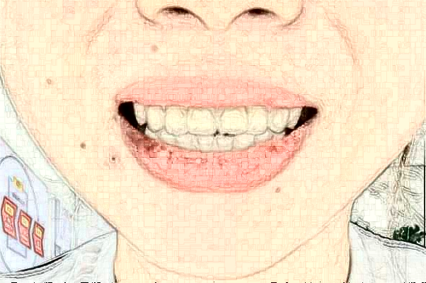 2024綿陽市中心醫(yī)院種植牙修復做的好嗎?誰做得好