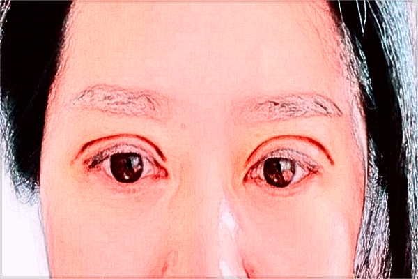 綿陽市中心醫(yī)院割雙眼皮價位多少_醫(yī)生介紹