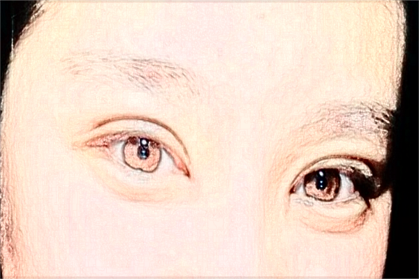 綿陽市中心醫(yī)院割雙眼皮價位多少_醫(yī)生介紹